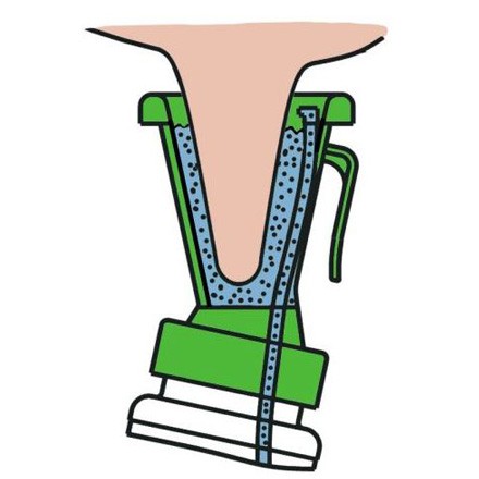 Dip Cup  Non Reflow Nipple Cleaning Disinfection Dip Cup for Cow Sheep Goat by Blisstime